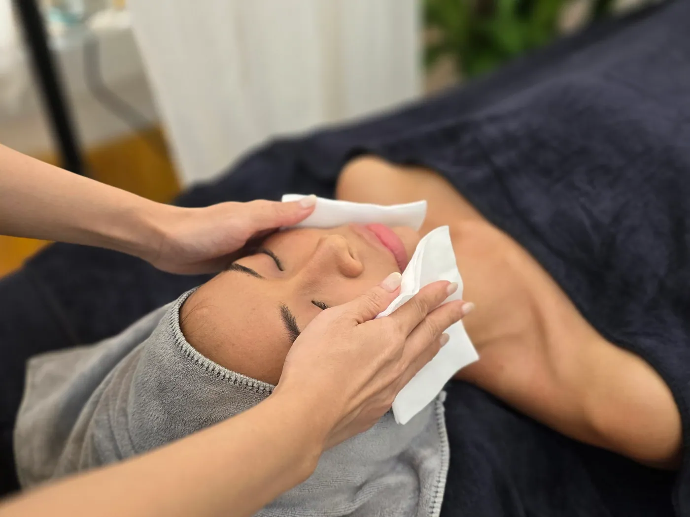 Acne Care Treatment